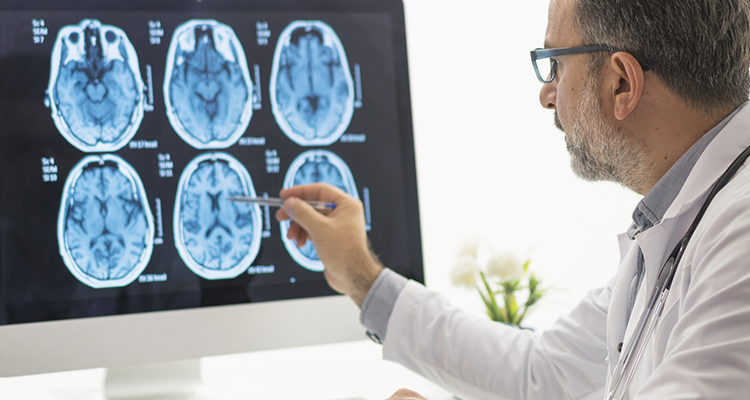 A importância do check-up anual para a saúde cerebral