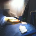 cirurgia-coluna-macaco-hidraulico-10-150x150