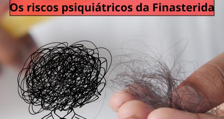 Finasterida: alerta sobre os riscos psiquiátricos do medicamento para calvície